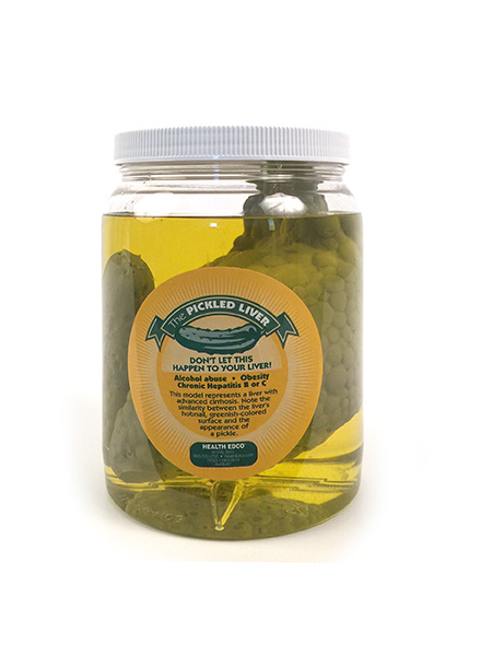 Pickled Liver - Alcohol Prevention Model